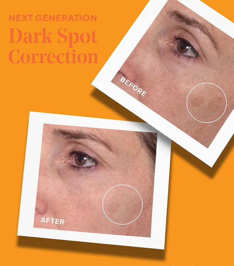 Murad rapid dark spot correcting serum 30ml, imported from the UK