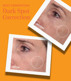 Murad rapid dark spot correcting serum 30ml, imported from the UK