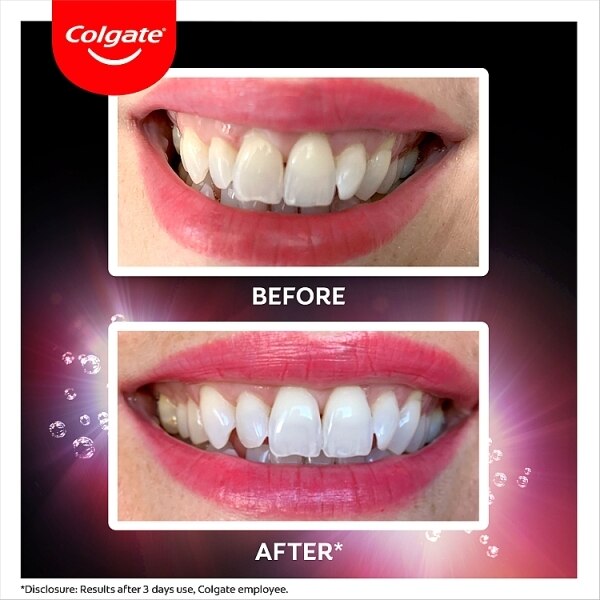 Colgate Max Ultra Fresh Pearls Whitening Toothpaste 75Ml GOODS Superdrug   