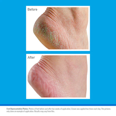 Crème hydratante O'Keeffe's Healthy Feet, tube 85g