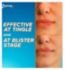 Crème Zovirax Bouton de fièvre Aciclovir Pompe 2g