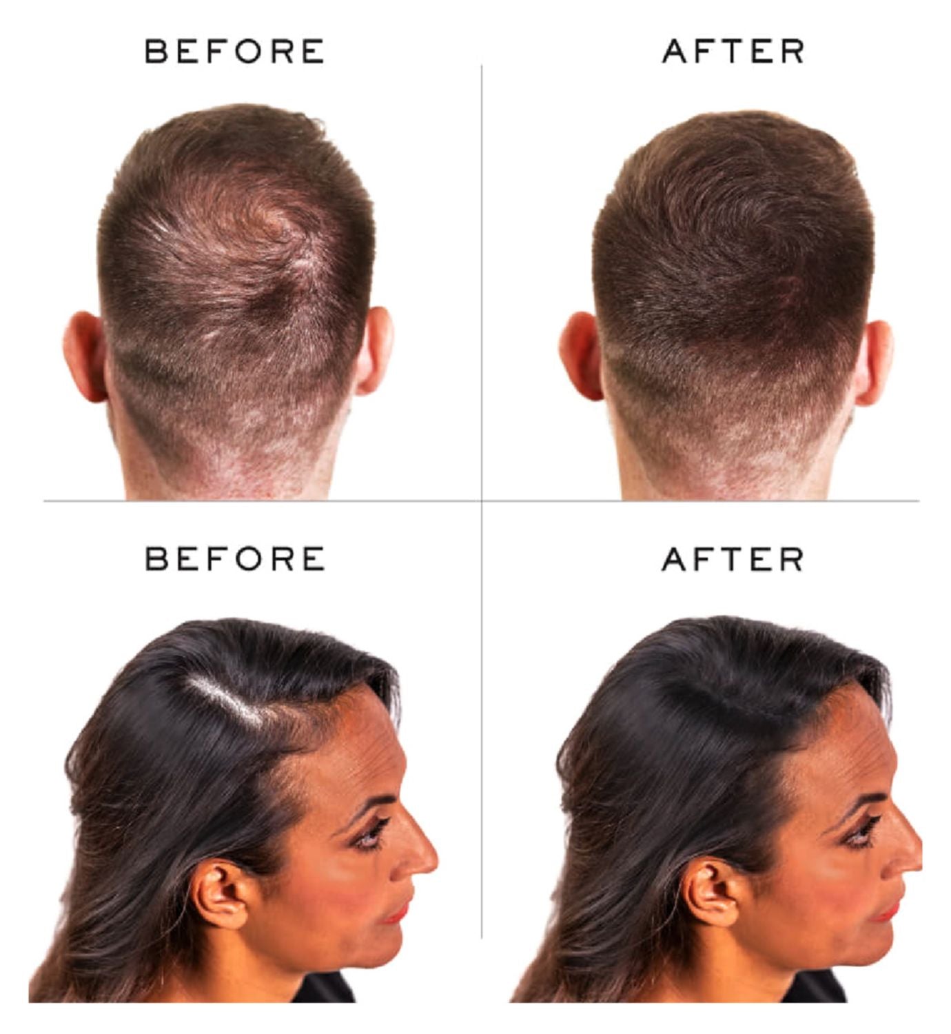 Nanogen hair thickening fibres dark brown 30g, imported from the UK