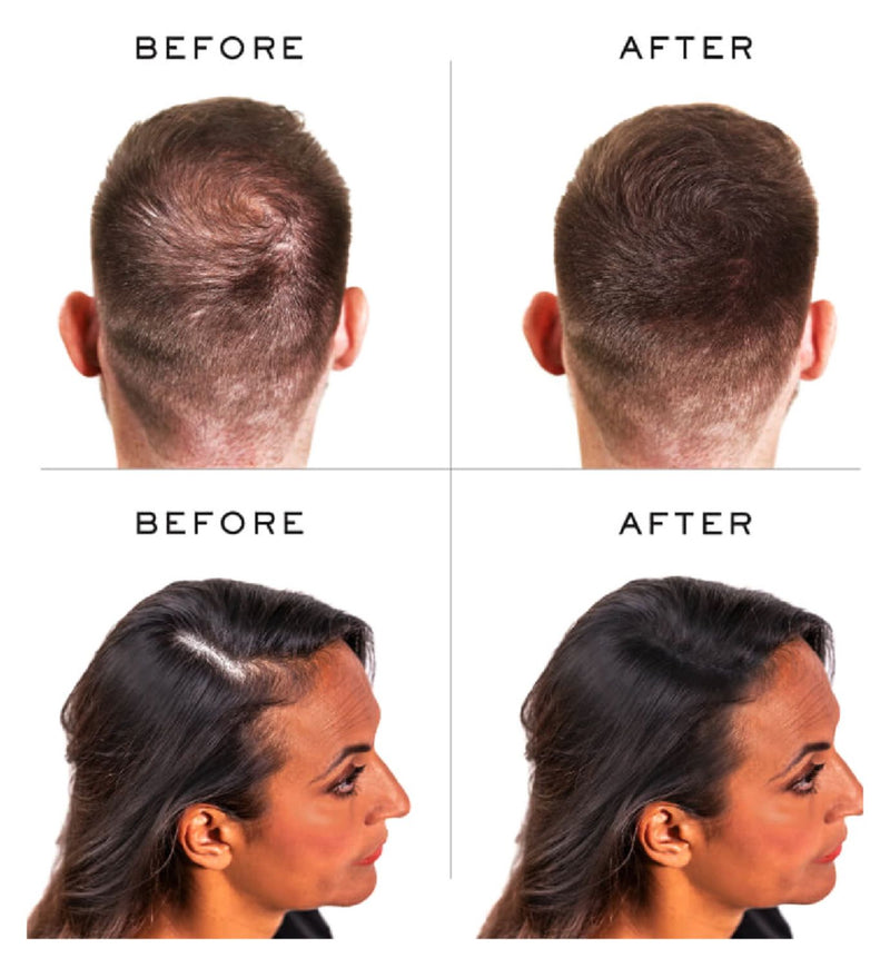 Nanogen hair thickening fibres dark brown 30g, imported from the UK
