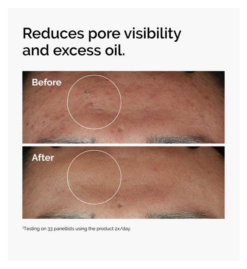 The Ordinary Niacinamide 10% Zinc serum 60ml - British product