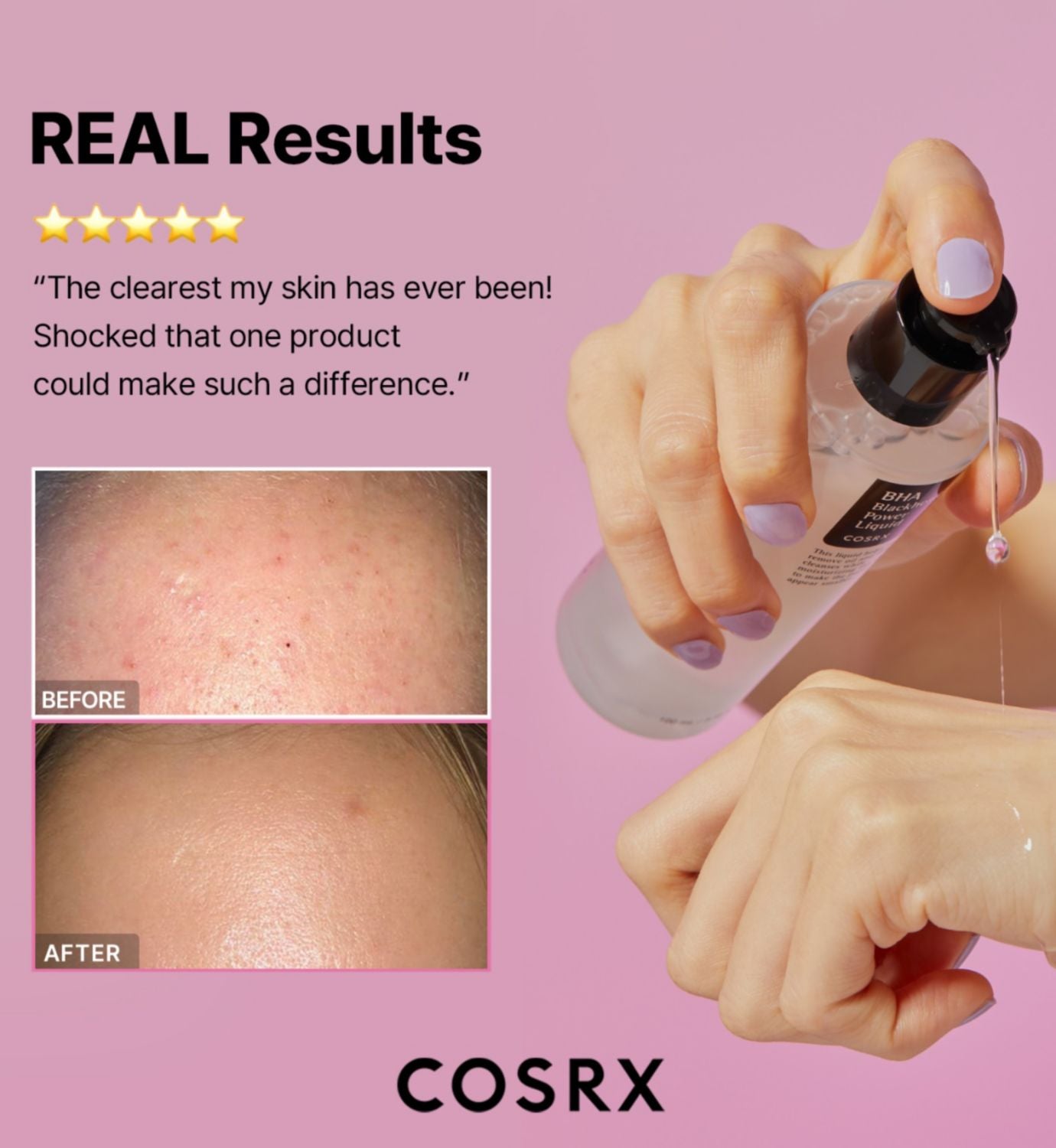 COSRX BHA Blackhead Power Liquid 100ml (British brand)
