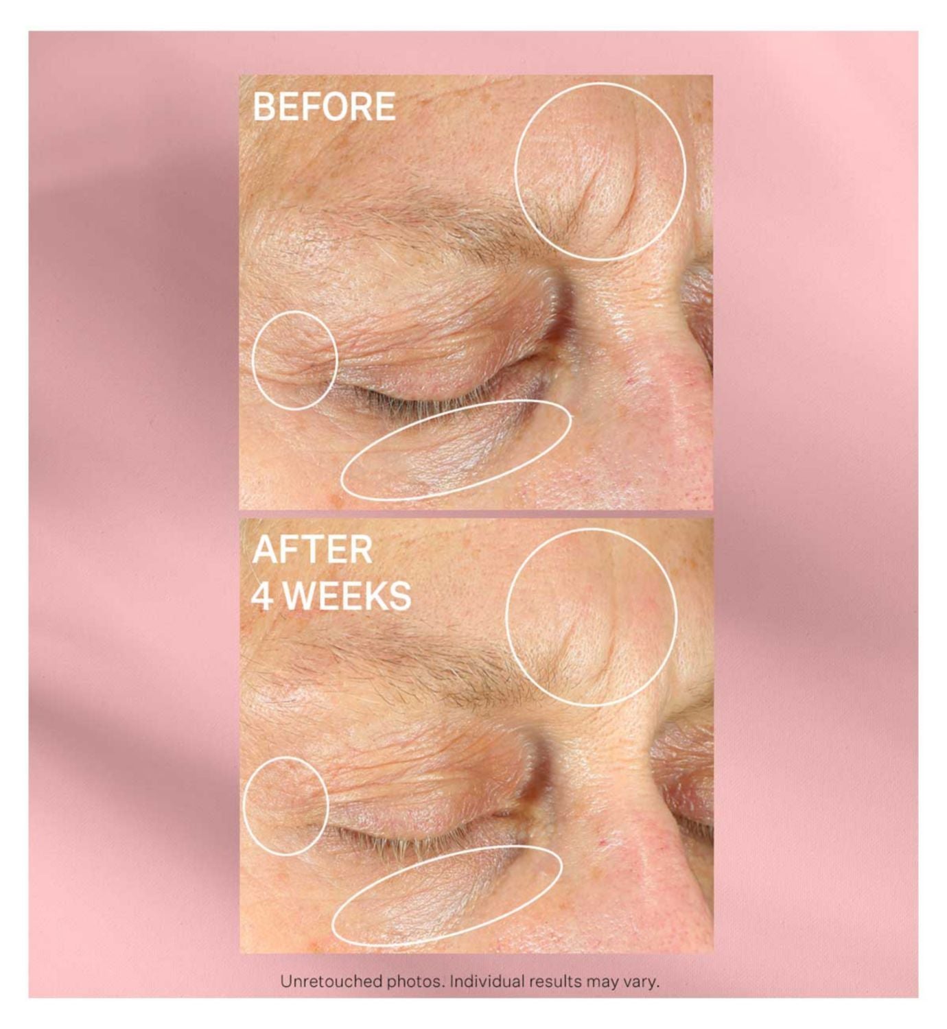 StriVectin Intensive Eye Concentrate Plus anti-wrinkle eye cream - British product