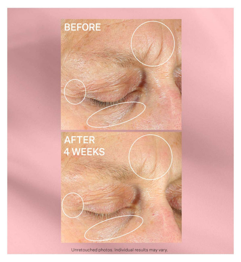StriVectin Intensive Eye Concentrate Plus anti-wrinkle eye cream - British product