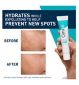 CeraVe Blemish Control Gel Feuchtigkeitscreme mit 2 % Salicylsäure 40ml