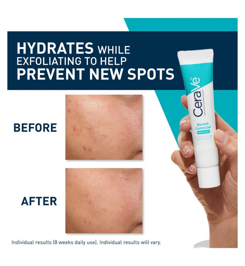 CeraVe Blemish Control Gel Moisturiser 2% Salicylic Acid 40ml - British product