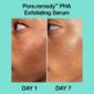Dr Jart+ Pore Remedy PHA serum 30ml - British product