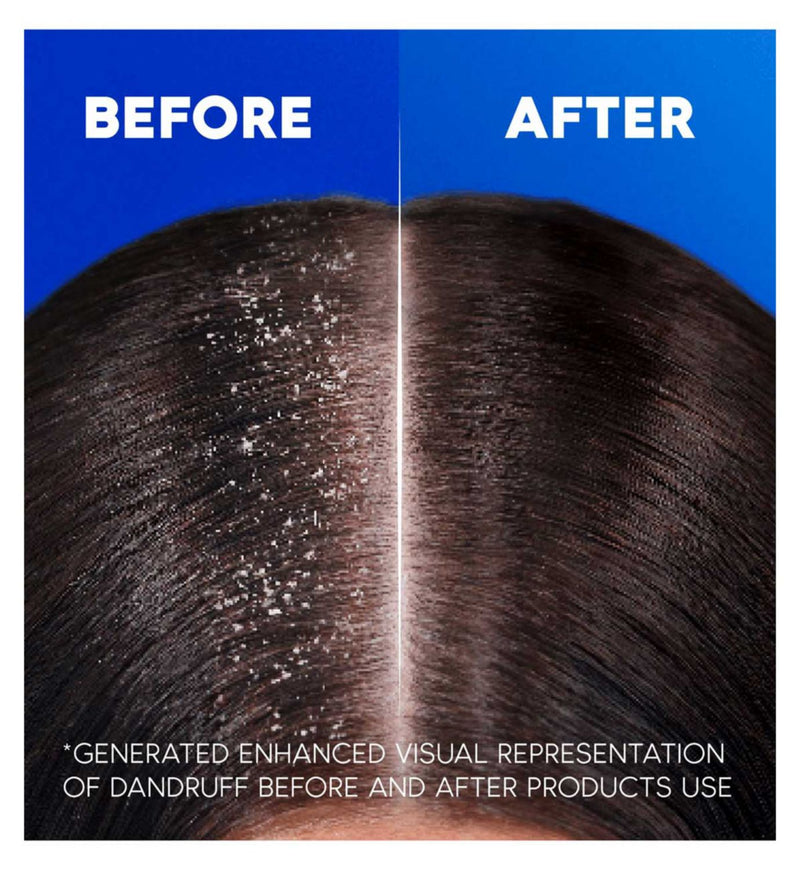 Head & Shoulders anti-dandruff shampoo Deep Hydration 400ml, UK version