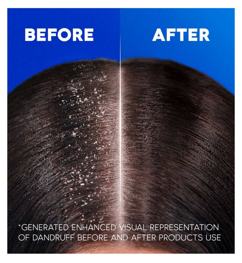 Head & Shoulders Classic Clean shampoo 400ml, UK version