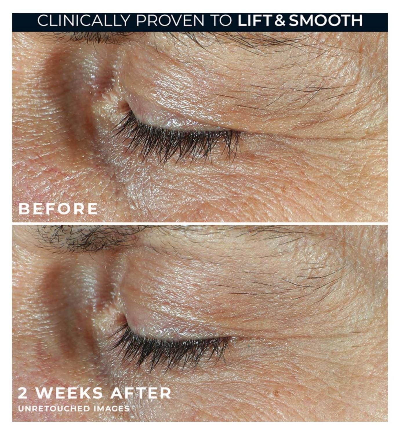RoC Derm Correxion dual eye cream 20ml, imported from the UK