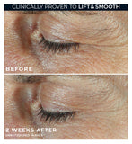 RoC Derm Correxion dual eye cream 20ml, imported from the UK