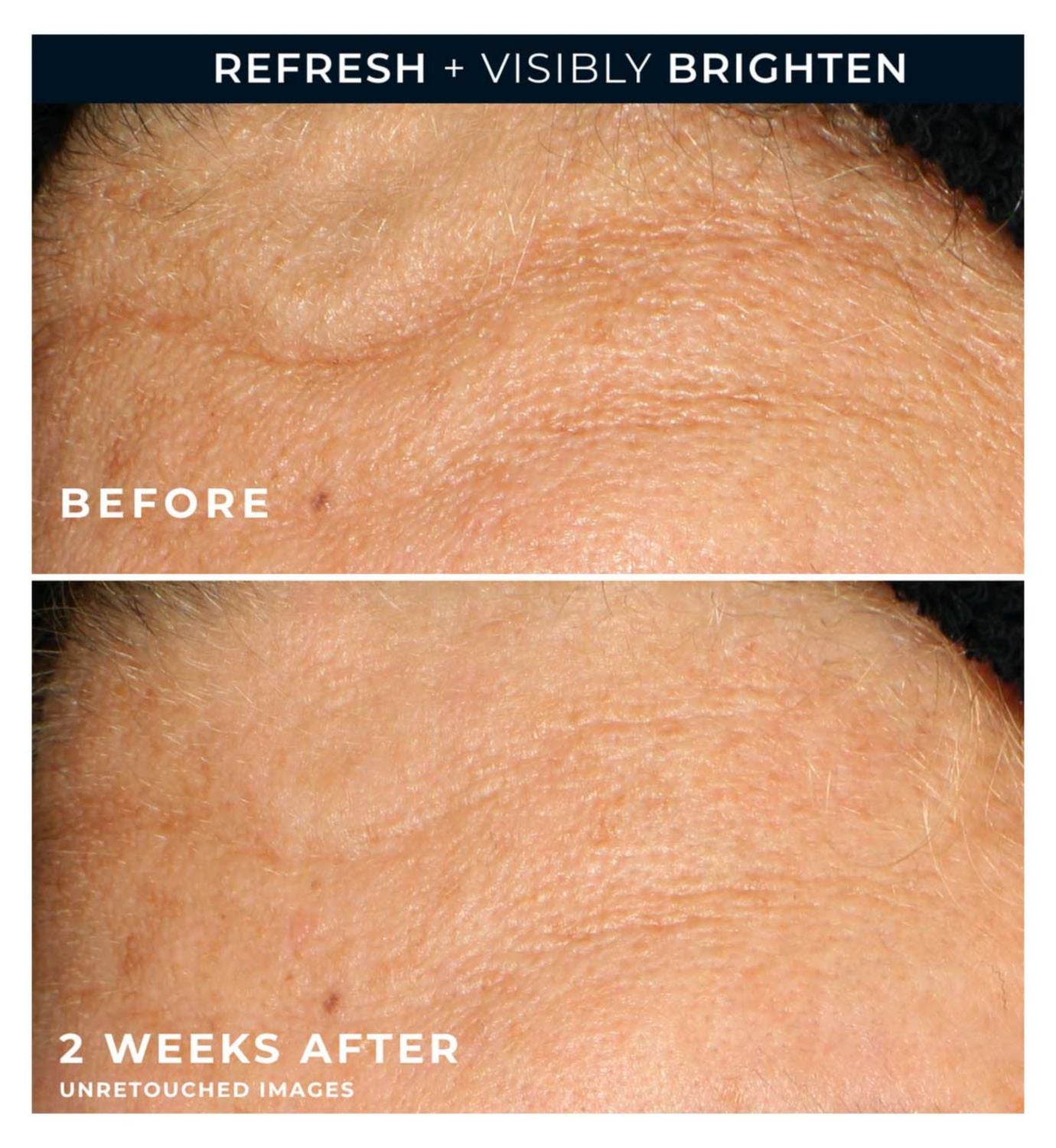 RoC Multi Correxion Vitamin C gel cleanser 177ml, imported from the UK