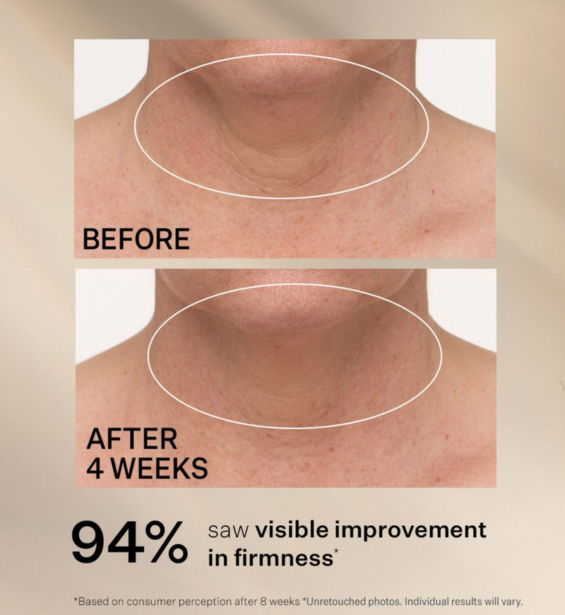 Strivectin TL Advanced Neck Cream 30ml, imported from the UK