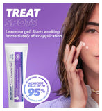 Acnecide acne treatment bundle with gel and patches - British product