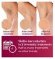 Philips Lumea IPL Hair Removal Device imported from the UK