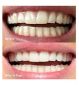Gem PAP dissolvable whitening strips 28 sachets, UK version