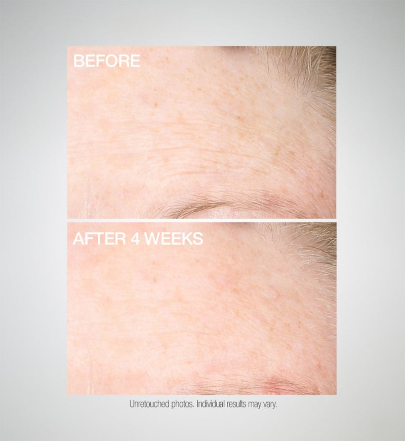 StriVectin SD Advanced Plus intensive moisturizer 60ml UK version
