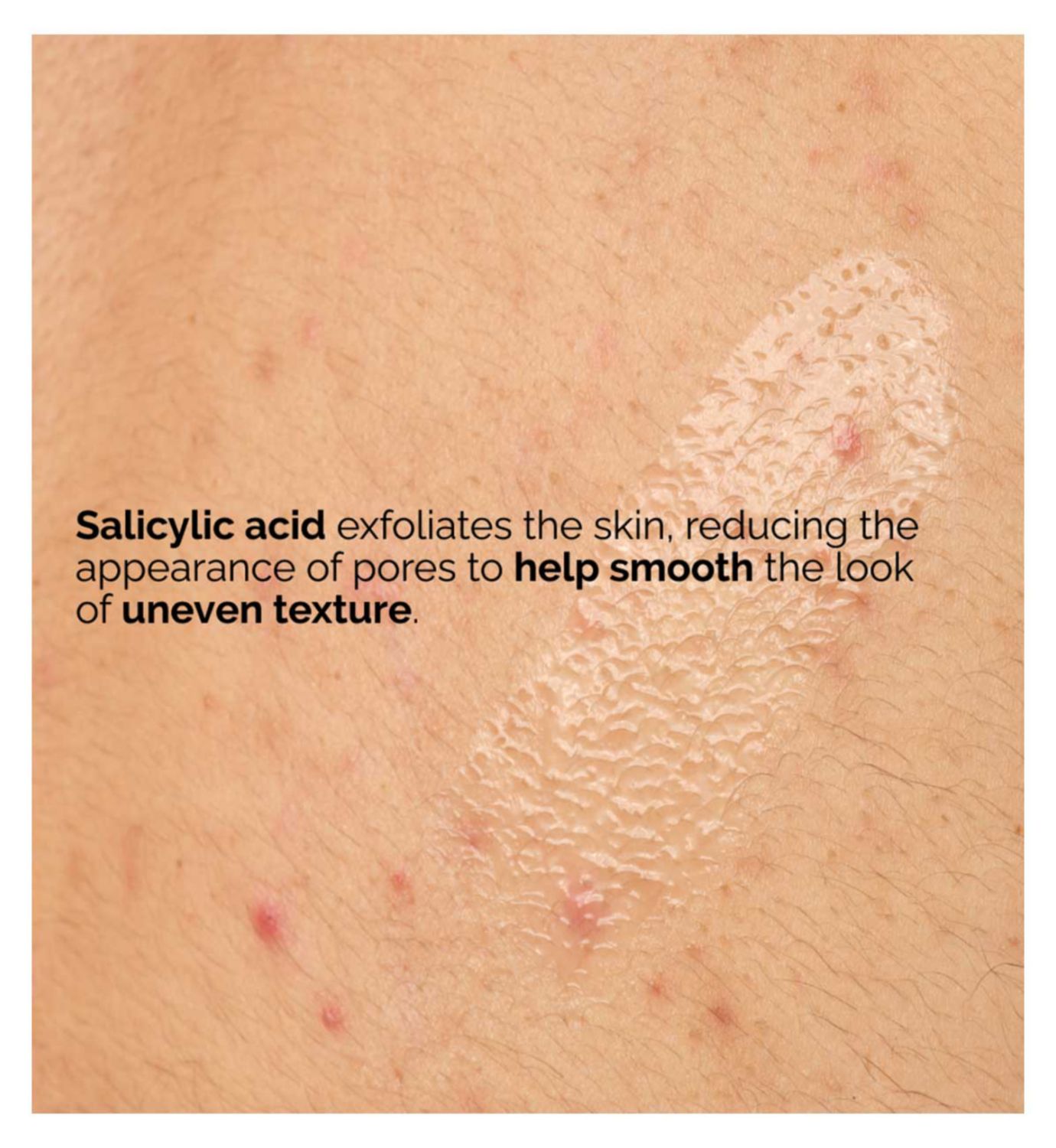 The Ordinary Salicylic Acid 0.5% Body Serum - British product