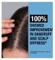 Neutrogena T/Gel shampoo scalp relief 150ml, imported from the UK