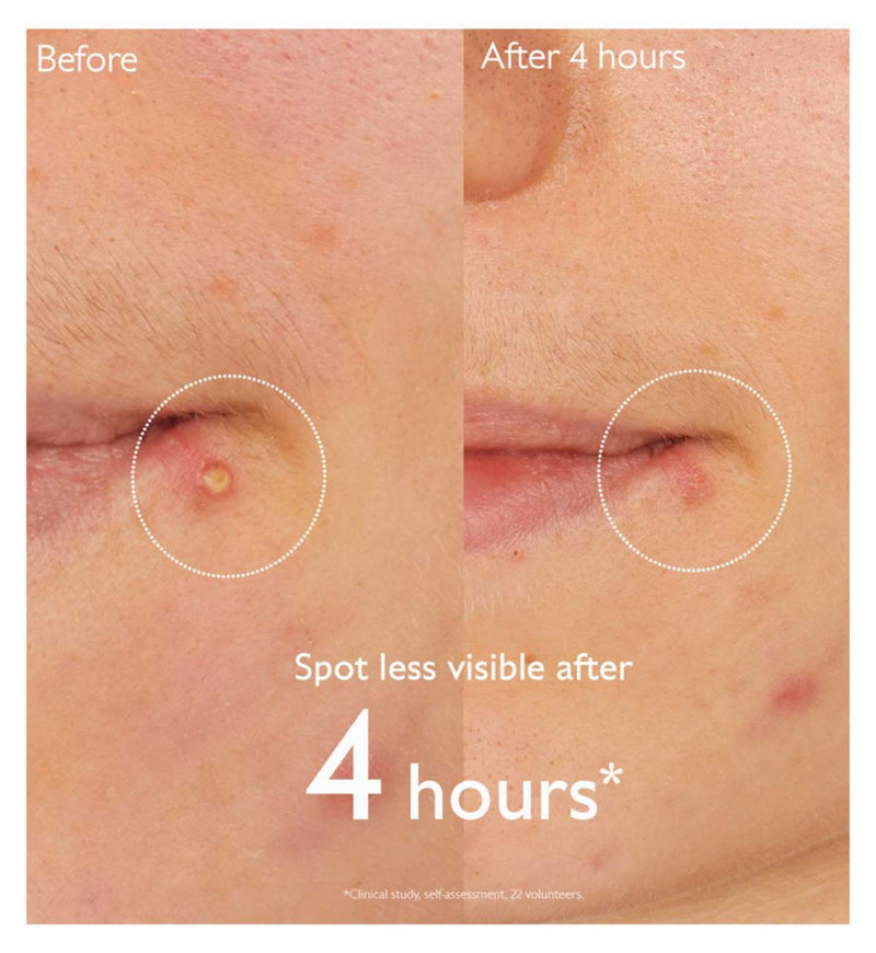 Caudalie Vinopure Salicylic Spot Solution 15ml - British product