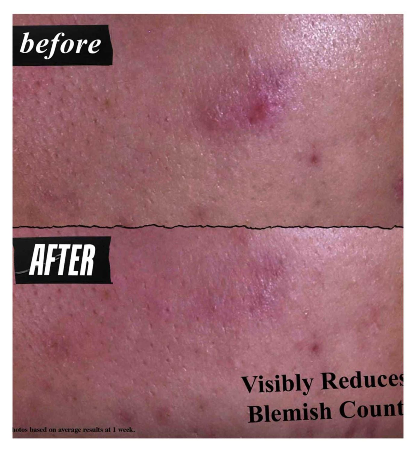 Kiehl's Expert Blemish Cleanser 125ml, imported from the UK