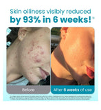 Clean Skin Club face towels Blemish Control 50 count (British brand)