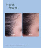 ROH Scalp Renew Serum 50ml, UK version