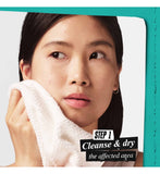 Kiehl's blemish patch with hydrocolloid, UK version