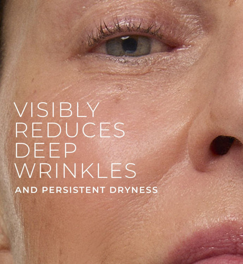 RoC Retinol Correxion Deep Wrinkle Cream 50ml - British product