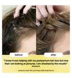 Bondiboost HG Lock Drops scalp serum 30ml - British product