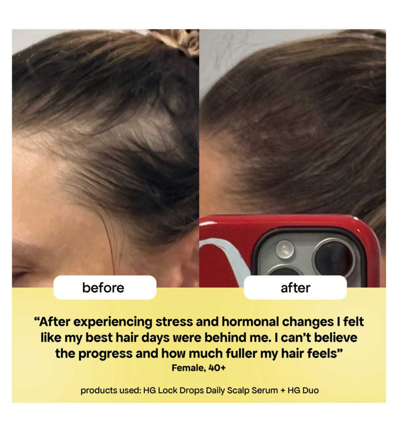 Bondiboost HG Lock Drops scalp serum 30ml - British product