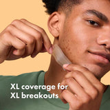 Hero Mighty Surface pimple patches XL 10 count, imported from the UK