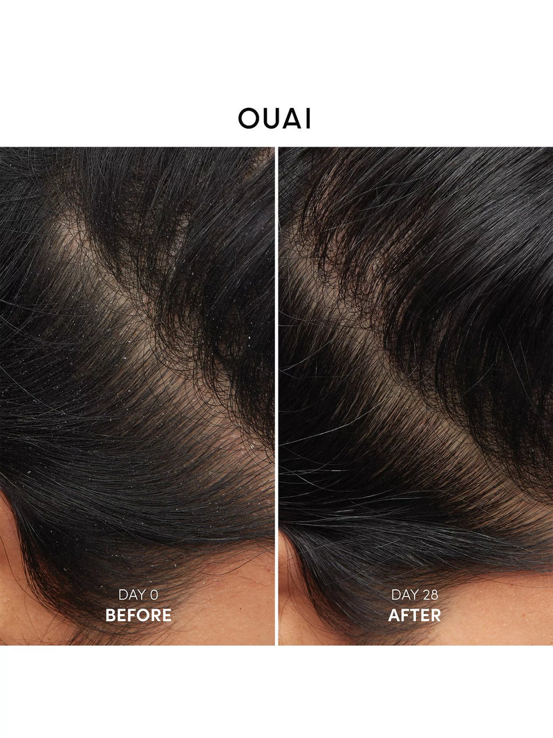 OUAI anti-dandruff shampoo with salicylic acid 300ml, imported from the UK