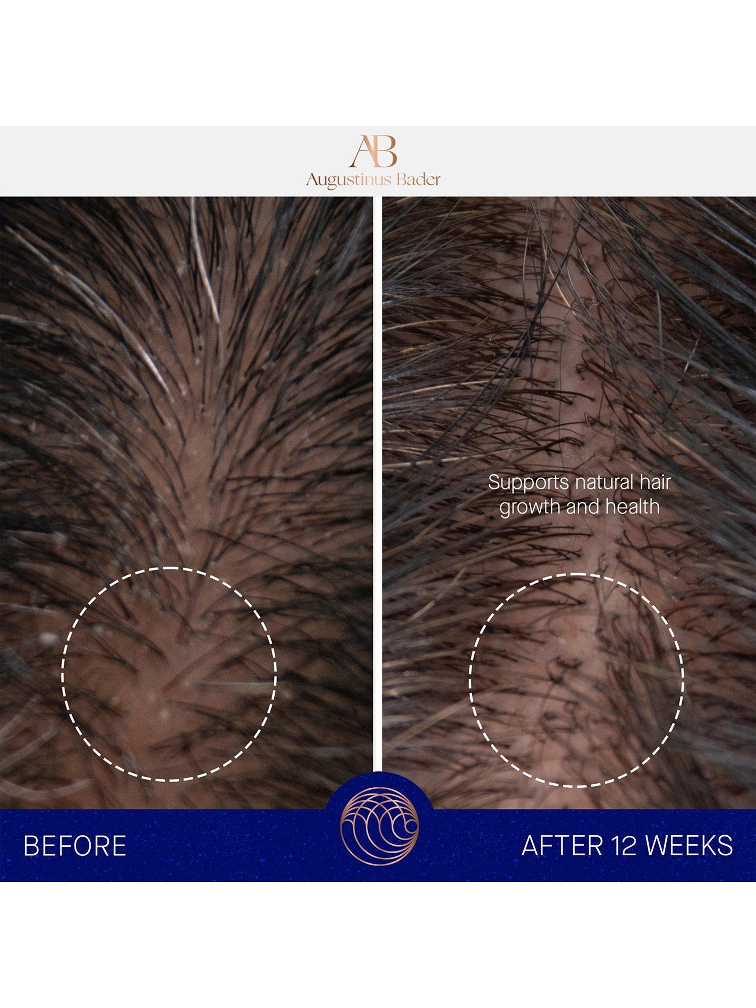 Augustinus Bader leave-in hair treatment 100ml - British product