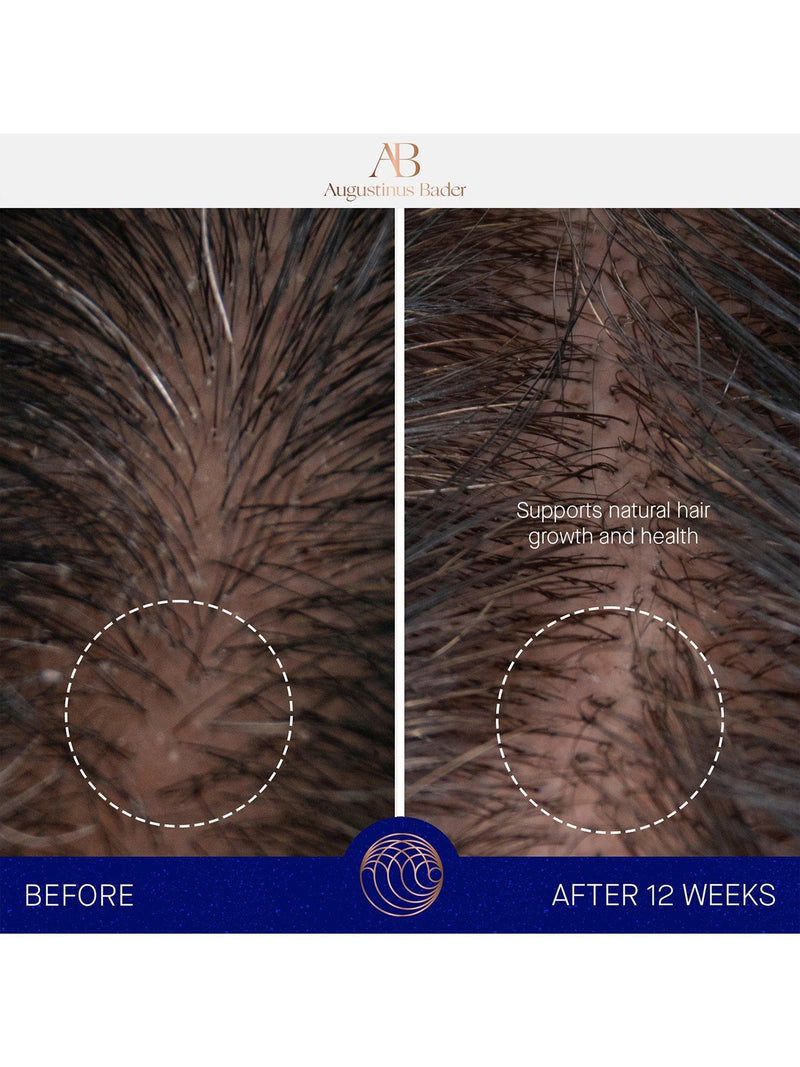 Augustinus Bader leave-in hair treatment 100ml - British product