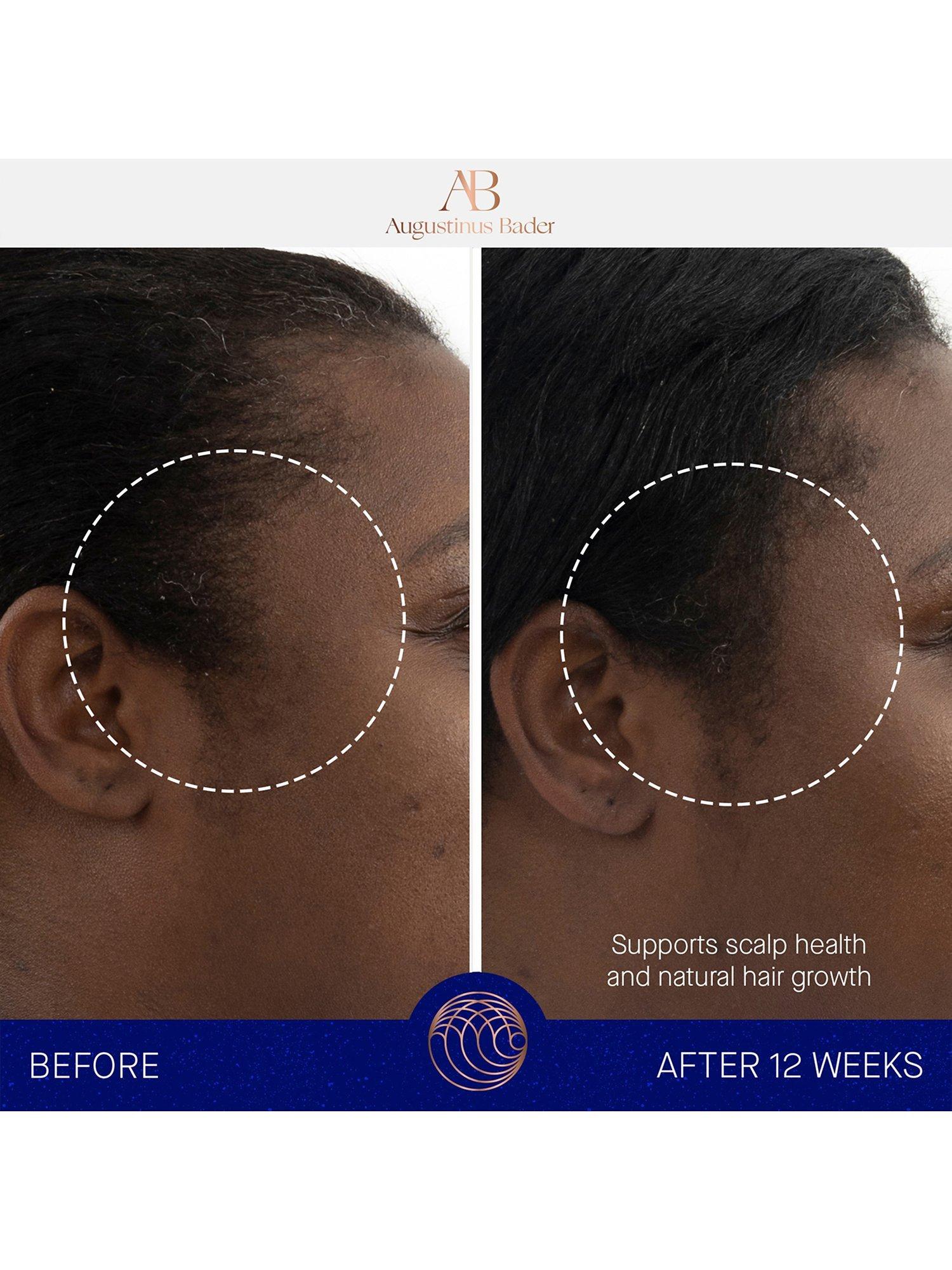 Augustinus Bader scalp treatment serum 30ml - British product