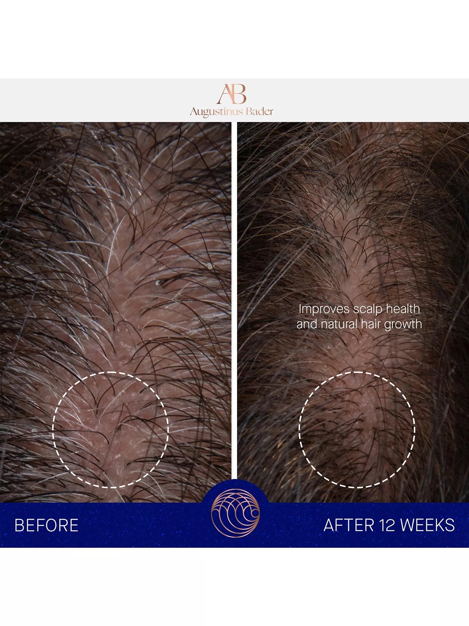 Augustinus Bader scalp treatment serum 30ml - British product