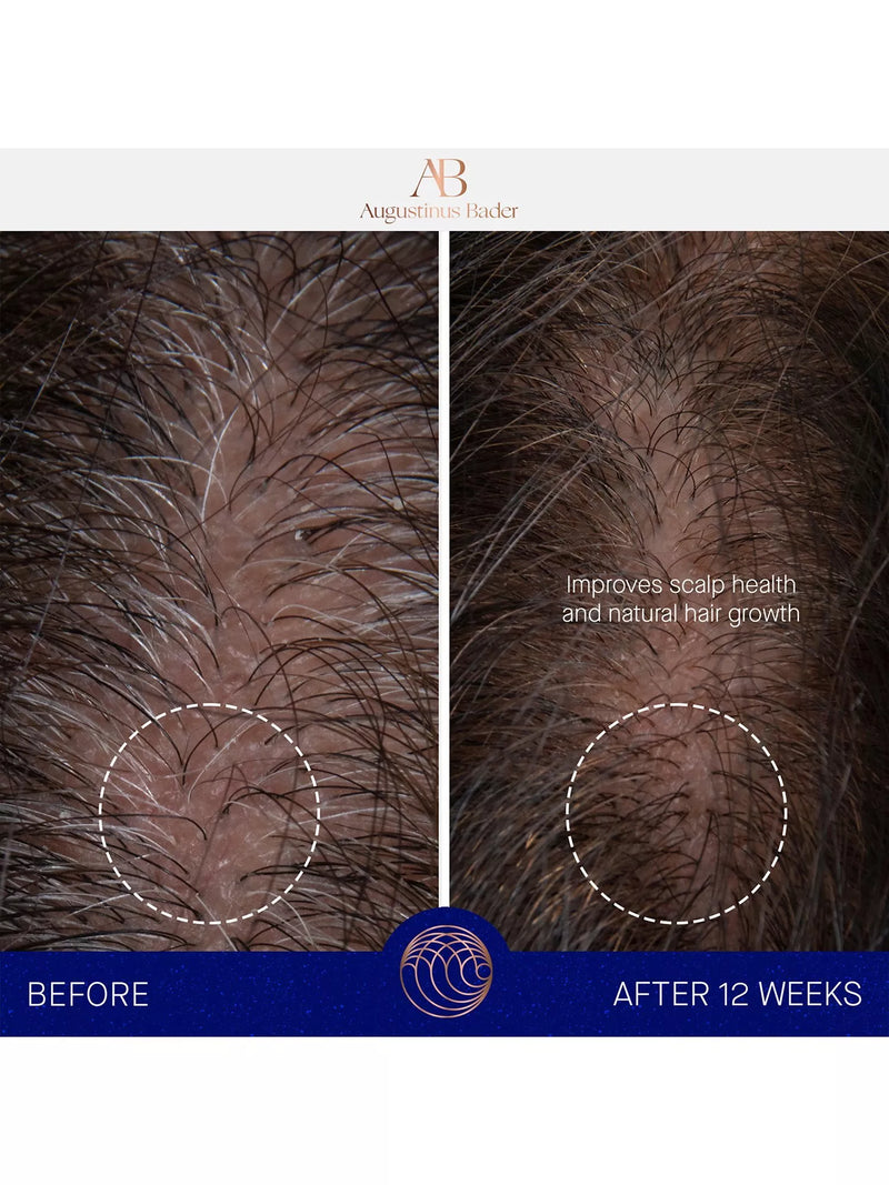 Augustinus Bader scalp treatment serum 30ml - British product