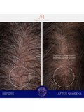 Augustinus Bader scalp treatment serum 30ml - British product