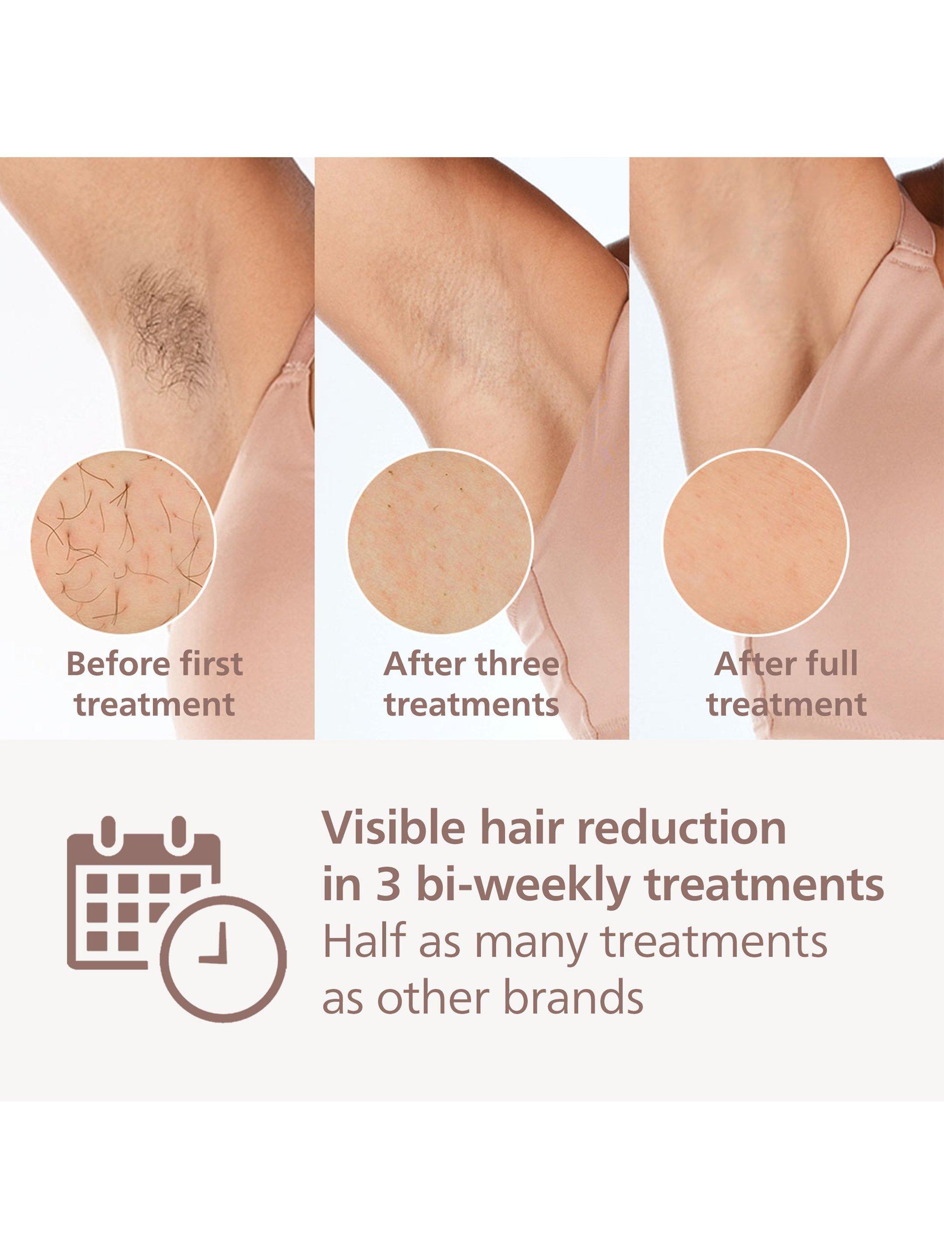 Philips Lumea 8000 Series IPL hair removal device white, imported from the UK