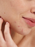 Pai Salicylsäure-klärender Booster 10ml - Britisches Produkt