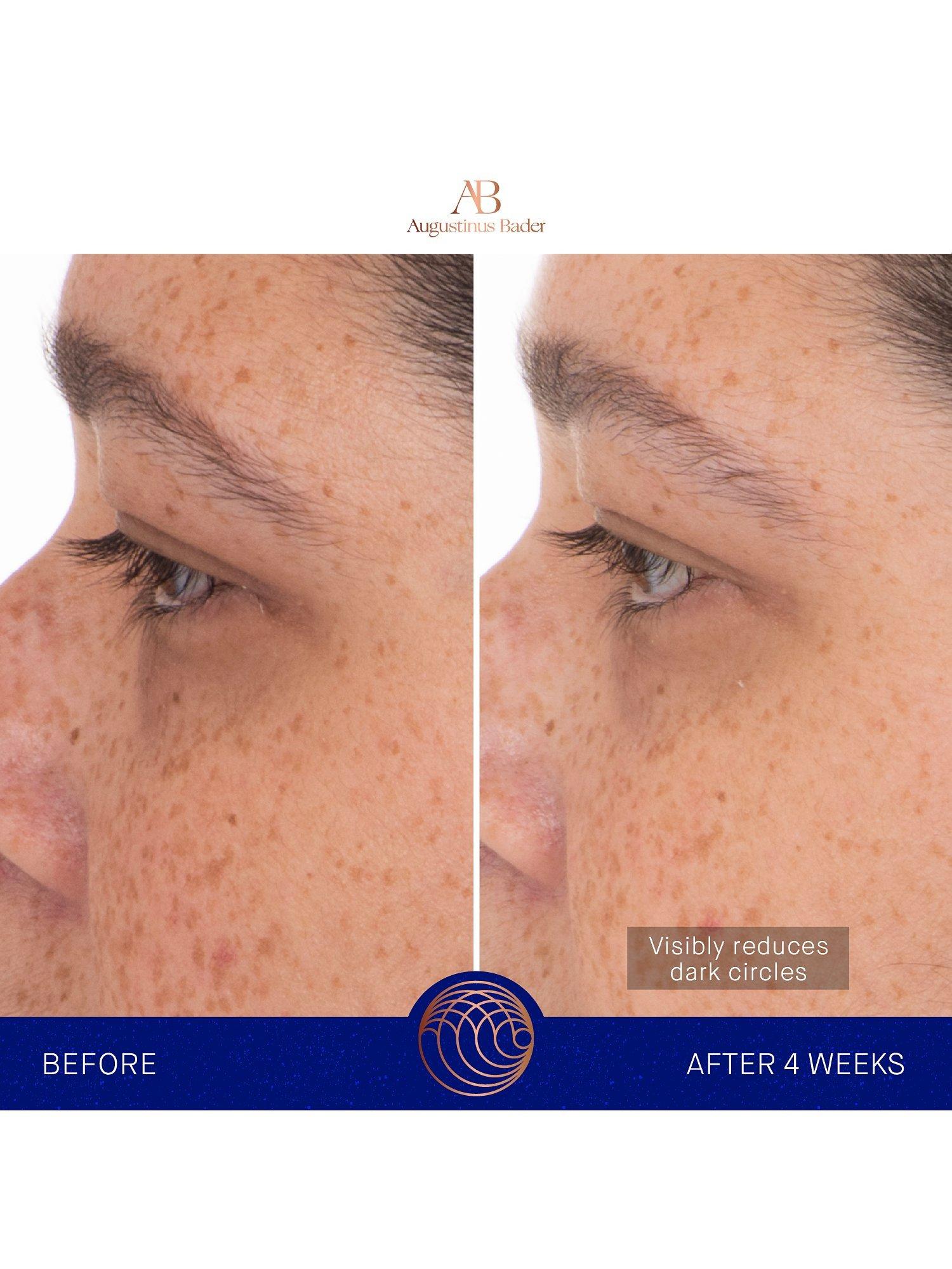 Augustinus Bader Hydrogel-Augenpads 6 Beutel, importiert aus dem Vereinigten Königreich