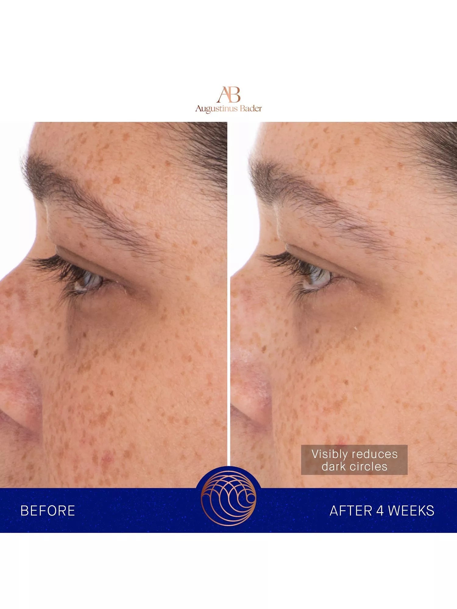 Augustinus Bader hydrogel eye patches 6 sachets, imported from the UK