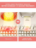 FOREO PEACH 2 IPL hair removal device (British brand)