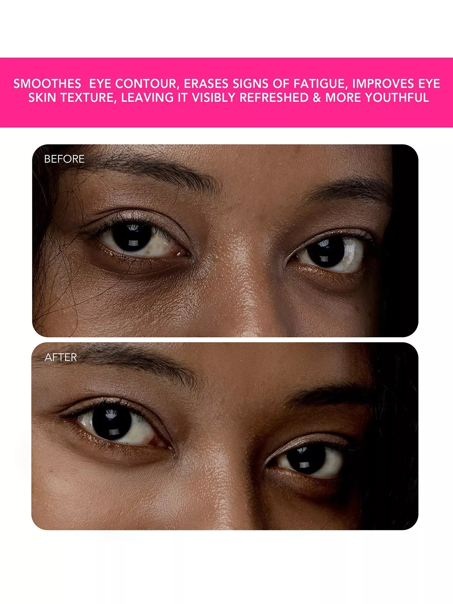 FOREO IRIS 2 eye massager in Fuchsia, imported from the UK