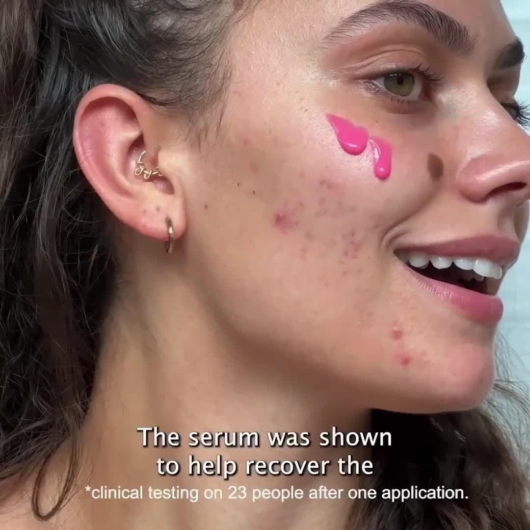 The Ordinary Beroligende og barriere-støttende serum 30ml, UK-versjon
