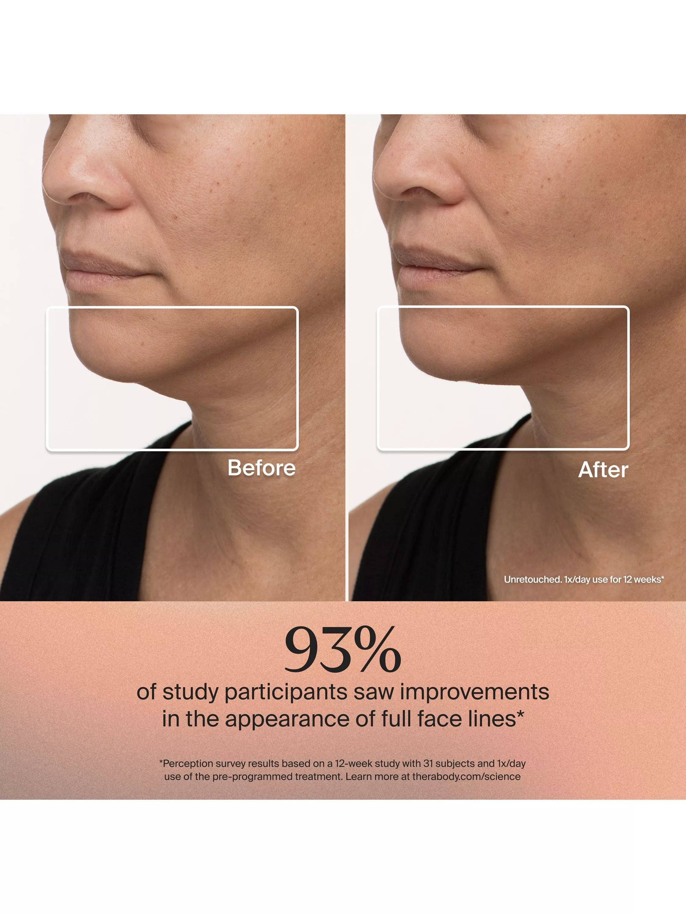 Therabody TheraFace LED Skincare Mask (British brand)